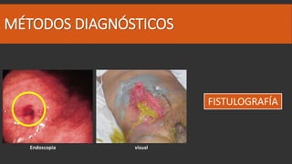 Fall Intestinal Falla intestinal | PPTX