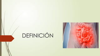 Fall Intestinal FALLA INTESTINAL EXPOSICION 2024 HOSPITAL PERU | PPTX