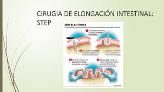 Fall Intestinal FALLA INTESTINAL EXPOSICION 2024 HOSPITAL PERU | PPTX