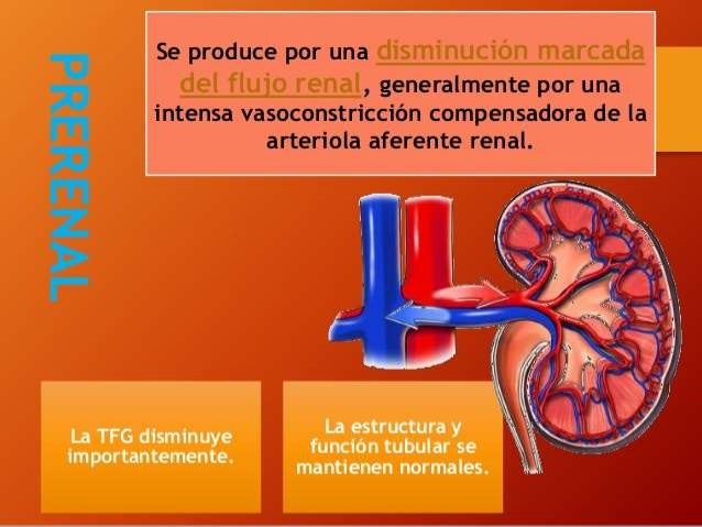 Sintomas De Falla Renal