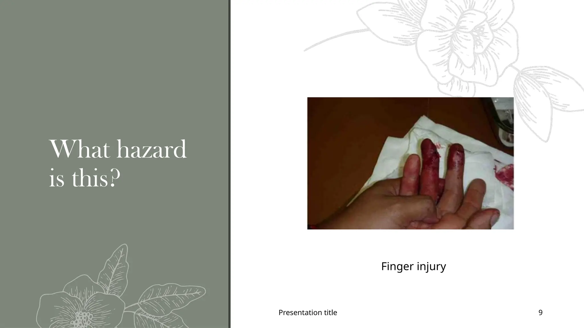 Presentation title 9
What hazard
is this?
Finger injury
 