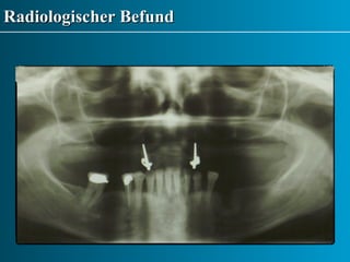 Radiologischer Befund 