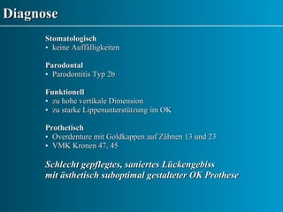 Diagnose Stomatologisch keine Auffälligkeiten Parodontal Parodontitis Typ 2b Funktionell zu hohe vertikale Dimension zu starke Lippenunterstützung im OK Prothetisch Overdenture mit Goldkappen auf Zähnen 13 und 23 VMK Kronen 47, 45 Schlecht gepflegtes, saniertes Lückengebiss  mit ästhetisch suboptimal gestalteter OK Prothese 