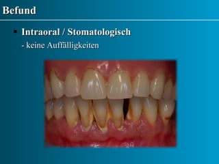 Befund Intraoral / Stomatologisch - keine Auffälligkeiten 