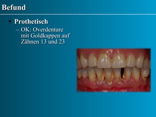 Befund Prothetisch OK: Overdenture mit Goldkappen auf Zähnen 13 und 23 