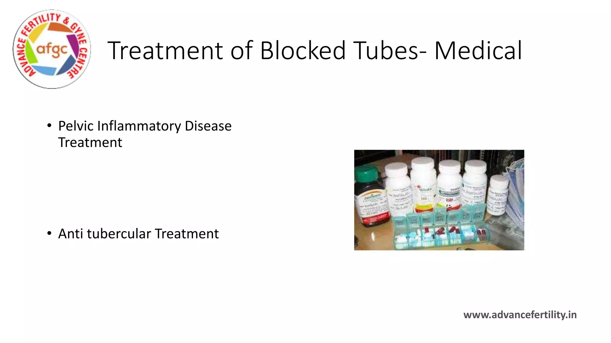 Fallopian tube blockage | PPTX