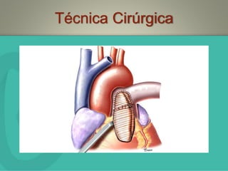 Técnica Cirúrgica
 