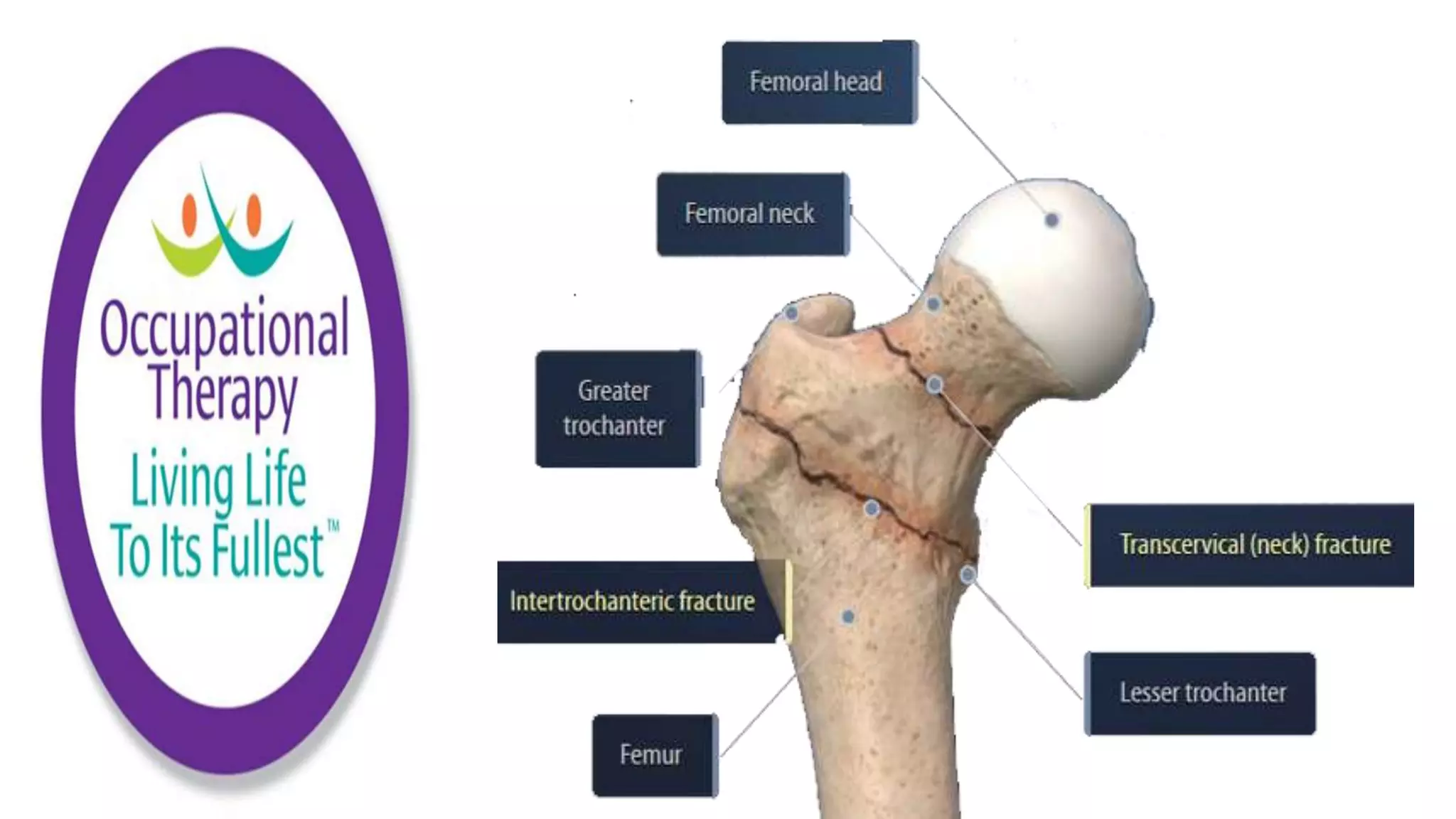 Fall Prevention Strategies Elderly Population part 1