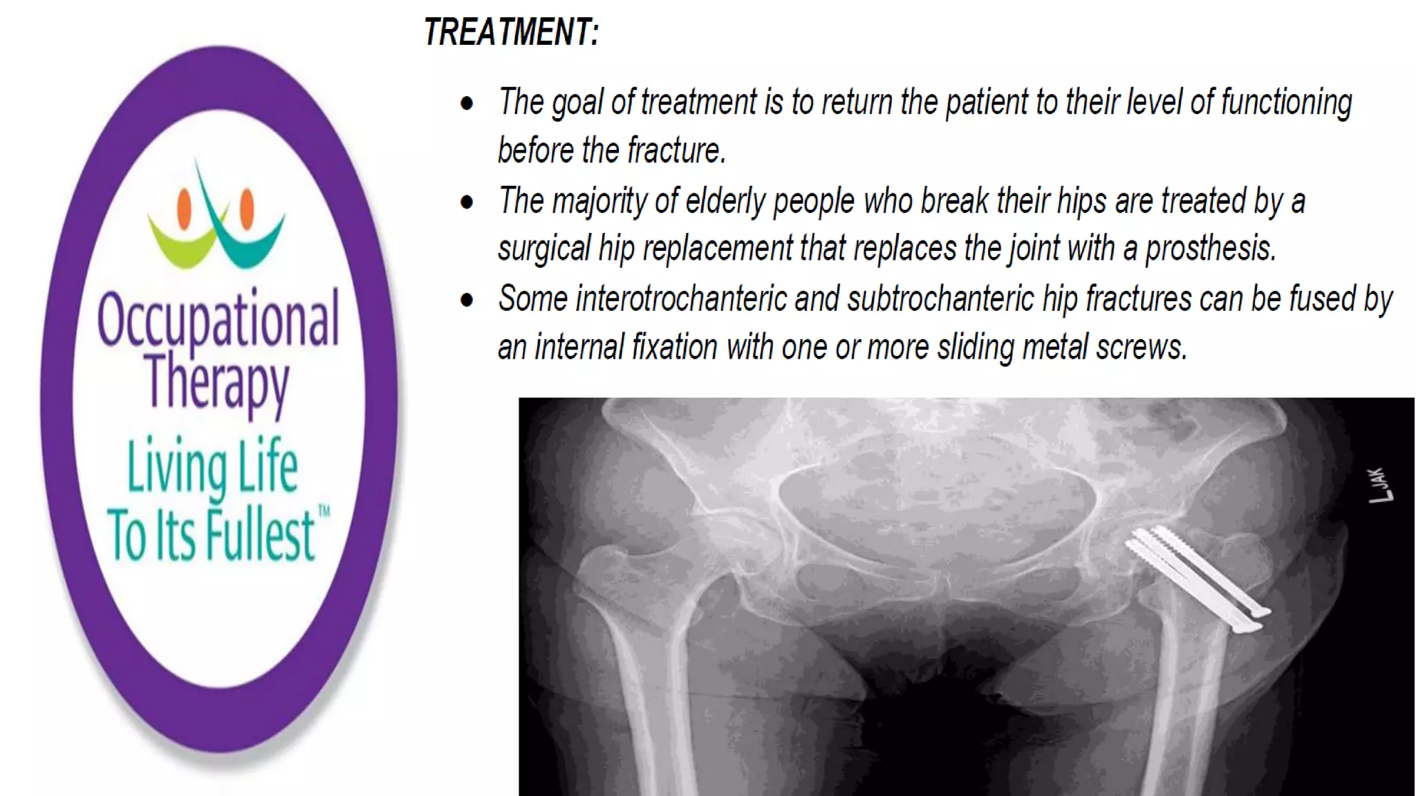Fall Prevention Strategies Elderly Population part 1