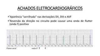 ACHADOS ELETROCARDIOGRÁFICOS
Aparência “serrilhada” nas derivações DII, DIII e AVF
Reversão da direção no circuito pode causar uma onda de flutter
(onda f) positiva
 