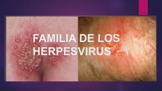 Familia de los herpesvirus.pptx