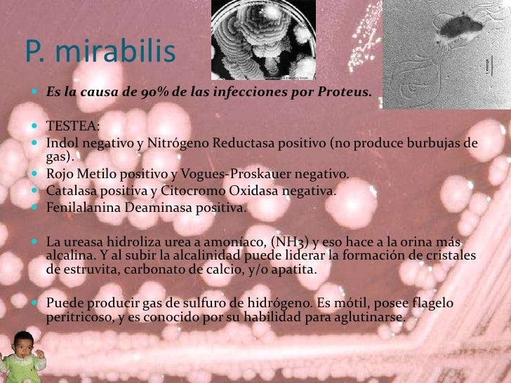 Proteus