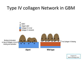 Type IV collagen Network in GBM
Cosgrov D.
Matrix biology,2016
 