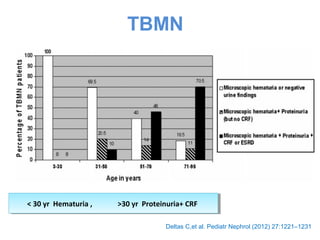 TBMN
< 30 yr Hematuria , >30 yr Proteinuria+ CRF< 30 yr Hematuria , >30 yr Proteinuria+ CRF
Deltas C,et al. Pediatr Nephrol (2012) 27:1221–1231
 
