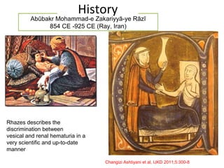 Abūbakr Mohammad-e Zakariyyā-ye Rāzī
854 CE -925 CE (Ray, Iran)
Rhazes describes the
discrimination between
vesical and renal hematuria in a
very scientific and up-to-date
manner
Changizi Ashtiyani et al, IJKD 2011;5:300-8
History
 