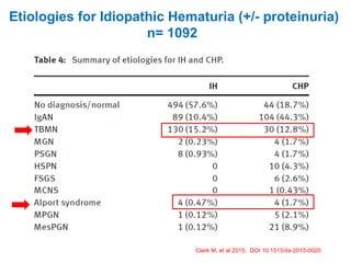 Etiologies for Idiopathic Hematuria (+/- proteinuria)
n= 1092
Clark M, et al 2015, DOI 10.1515/dx-2015-0020
 