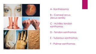 A- Xanthelasma
B – Corneal arcus
(Arcus senilis)
C - Achilles tendon
xanthomas
D - Tendon xanthomas
E - Tuberous xanthomas
F - Palmar xanthomas
 