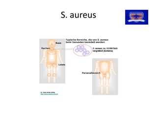 S. aureus
S. aureus 
 