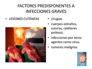 FACTORES PREDISPONENTES A 
           INFECCIONES GRAVES 
•  LESIONES CUTÀNEAS    •  cirugías 
                        •  cuerpos extraños, 
                           suturas, catéteres 
                           prótesis. 
                        •  infecciones por otros 
                           agentes como virus. 
                        •  tumores malignos
 