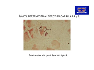 70­80% PERTENECEN AL SEROTIPO CAPSULAR 7 y 8 
   80% PERTENECEN AL SEROTIPO CAPSULAR 7 y 8 




       Resistentes a la penicilina serotipo 5
       Resistentes a la penicilina serotipo 5 
 