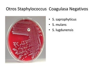 Otros Staphylococcus  Coagulasa Negativos 

                     •  S. saprophyticus 
                     •  S. mulans 
                     •  S. lugdunensis
 