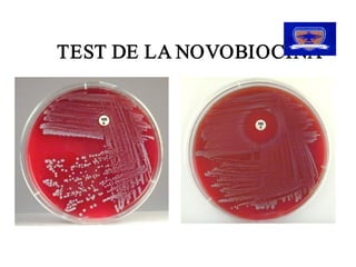 TEST DE LA NOVOBIOCINA
TEST DE LA NOVOBIOCINA 
 