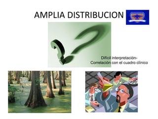 AMPLIA DISTRIBUCION 



                  Difícil interpretación­ 
            Correlación con el cuadro clínico
 