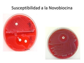 Susceptibilidad a la Novobiocina
Susceptibilidad a la Novobiocina 
 
