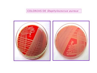 COLON I AS DE  Staphylococcus aureus 
               Staphylococcus aureus
 