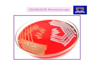 AS DE  Micrococcus spp
COLON I AS DE 
 