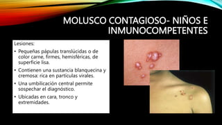 MOLUSCO CONTAGIOSO- NIÑOS E
INMUNOCOMPETENTES
Lesiones:
• Pequeñas pápulas translúcidas o de
color carne, firmes, hemisféricas, de
superficie lisa.
• Contienen una sustancia blanquecina y
cremosa: rica en partículas virales.
• Una umbilicación central permite
sospechar el diagnóstico.
• Ubicadas en cara, tronco y
extremidades.
 
