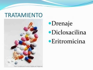 TRATAMIENTO
              Drenaje
              Dicloxacilina
              Eritromicina
 