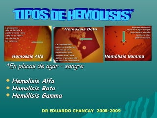 *En placas de agar – sangre*En placas de agar – sangre
 Hemolisis AlfaHemolisis Alfa
 Hemolisis BetaHemolisis Beta
 Hemólisis GammaHemólisis Gamma
Hemolisis AlfaHemolisis Alfa
Hemolisis BetaHemolisis Beta
Hemólisis GammaHemólisis Gamma
DR EDUARDO CHANCAY 2008-2009
 