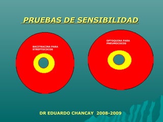 BACITRACINA PARA
STREPTOCOCOS
OPTOQUINA PARA
PNEUMOCOCOS
PRUEBAS DE SENSIBILIDADPRUEBAS DE SENSIBILIDAD
DR EDUARDO CHANCAY 2008-2009
 