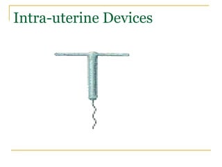 Intra-uterine Devices 