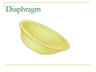 Diaphragm 