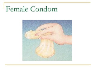 Female Condom 