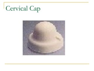 Cervical Cap 
