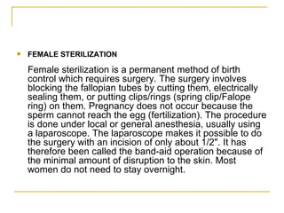 FEMALE STERILIZATION Female sterilization is a permanent method of birth control which requires surgery. The surgery involves blocking the fallopian tubes by cutting them, electrically sealing them, or putting clips/rings (spring clip/Falope ring) on them. Pregnancy does not occur because the sperm cannot reach the egg (fertilization). The procedure is done under local or general anesthesia, usually using a laparoscope. The laparoscope makes it possible to do the surgery with an incision of only about 1/2". It has therefore been called the band-aid operation because of the minimal amount of disruption to the skin. Most women do not need to stay overnight. 