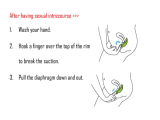 After having sexual intrecourse >>>
1.

Wash your hand.

2. Hook a finger over the top of the rim

to break the suction.
3. Pull the diaphragm down and out.

 