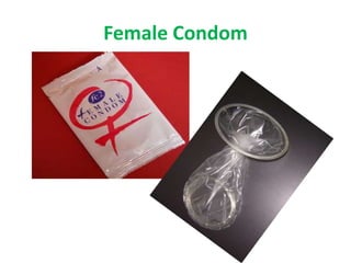 Female Condom

 