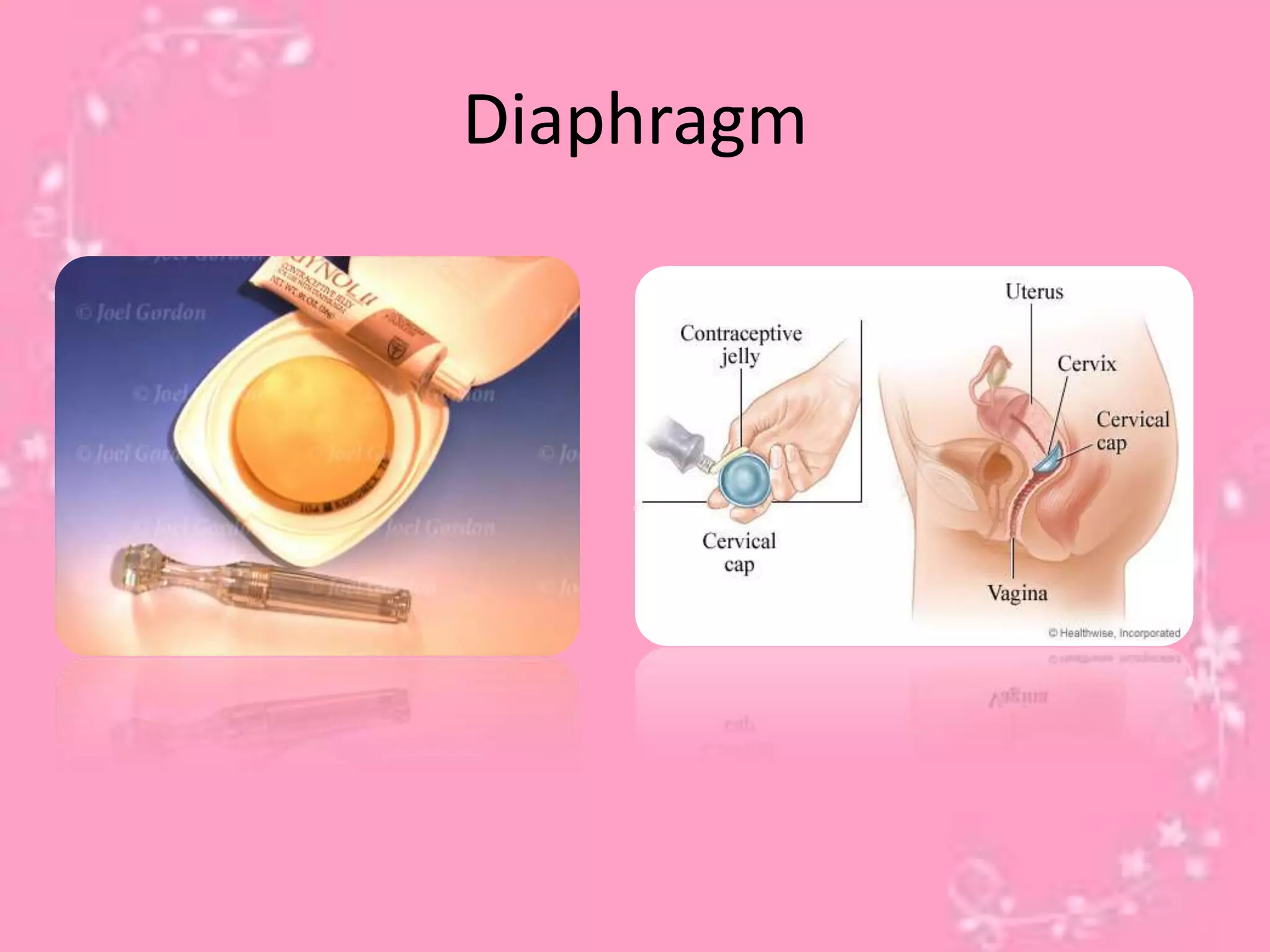 Diaphragm