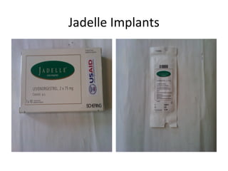 Jadelle Implants

 