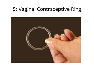5: Vaginal Contraceptive Ring

 