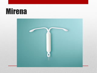 Mirena 
 