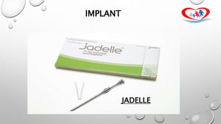 Family planning | PPTX