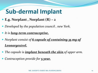 Norplant R2 Family planning Methods | PDF