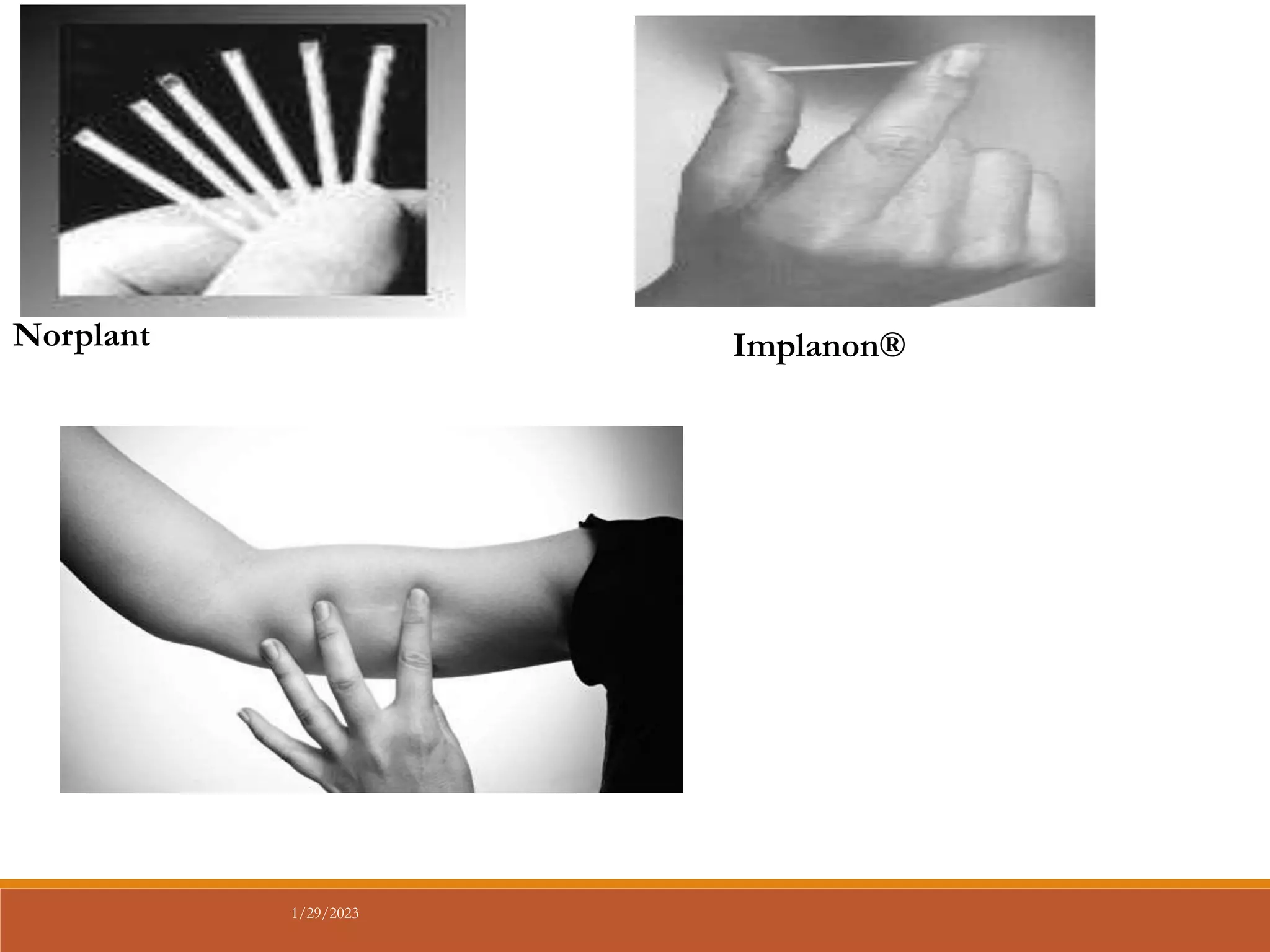 Norplant Implanon®
1/29/2023
 