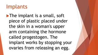 Implants
The implant is a small, soft
piece of plastic placed under
the skin in a woman's upper
arm containing the hormone
called progestogen. The
implant works by stopping your
ovaries from releasing an egg.
 