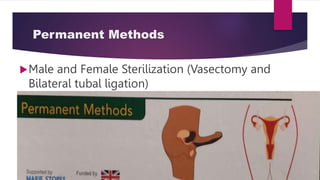 Permanent Birth Control Methods FAMILY PLANNING all you need to know about FP | PPTX